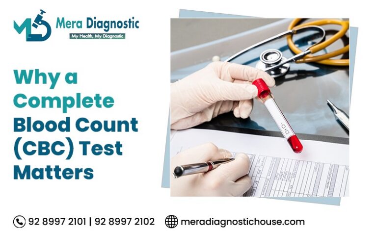 CBC-test